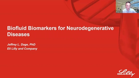 Thumbnail for SNRI Seminar Series: Jeff Dage, Ph.D.