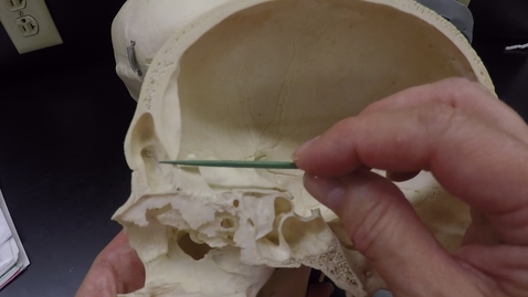 Thumbnail for Axial Skeleton 3