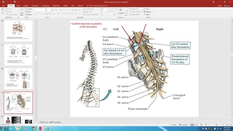 Thumbnail for IUSM WL - HS - 170823 - Walker