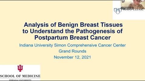 Thumbnail for entry IUSCCC Seminar Grand Rounds 11/12/2021: &quot;Analysis of Benign Breast Tissues to Understand the Pathogenesis of Postpartum Breast Cancer&quot;  Mark Sherman, MD, Professor of Epidemiology
Mayo Clinic College of Medicine
