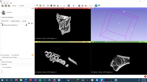 Thumbnail for entry Video 6 - 3D Slicer: Navigation