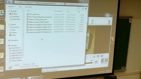 Thumbnail for Autoimmunity Immune Deficiency