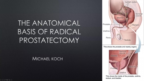 Thumbnail for entry 4.10.20 The Anatomical Basis of Radical Prostatectomy with Dr. Koch