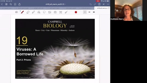 Thumbnail for K101_Ch19:Part2_Prions