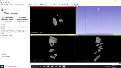 Thumbnail for Video 5.1 - 3D Slicer: Converting an Image Stack to NRRD