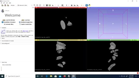 Thumbnail for entry Video 5.1 - 3D Slicer: Converting an Image Stack to NRRD