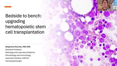 Thumbnail for IUSCCC Grand Rounds 2/27/2026: "Bedside to bench: upgrading hematopoietic stem cell transplantation" Stephanie Hurwitz, MD, PhD Assistant Professor of Pathology &amp; Laboratory Medicine Assistant Professor of Microbiology &amp; Immunology, IUSM