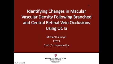 Thumbnail for entry Identifying changes in macular vascular density following branched and central retinal vein occlusions using OCTa