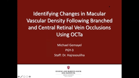 Thumbnail for Identifying changes in macular vascular density following branched and central retinal vein occlusions using OCTa