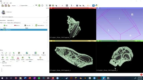 Thumbnail for entry Video 10 - 3D Slicer: Exporting a Mesh