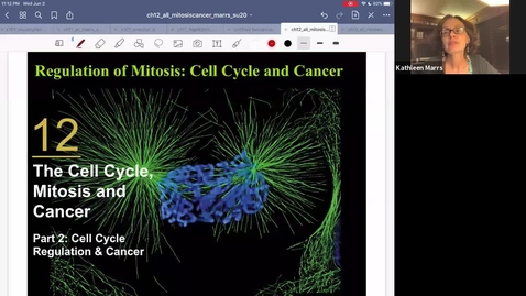 Thumbnail for K101_Ch12:Part2_Cancer