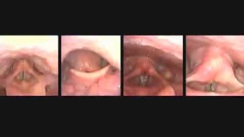 Thumbnail for Vocal Cords up close while singing
