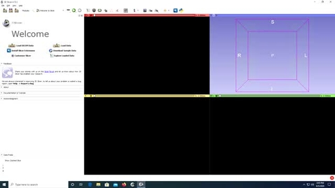 Thumbnail for entry Video 5 - 3D Slicer: Importing Data