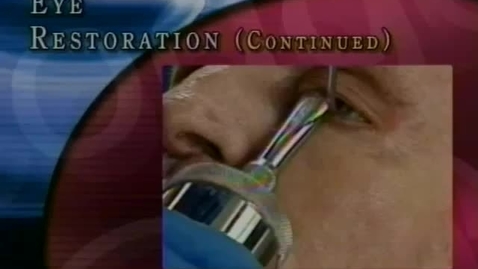 Thumbnail for preinjecteyerestore2
