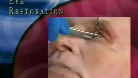 Thumbnail for preinjecteyerestore1