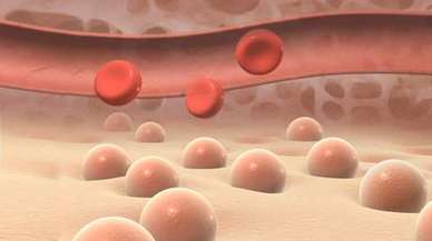 زراعة نخاع العظم Mayo Clinic مايو كلينك