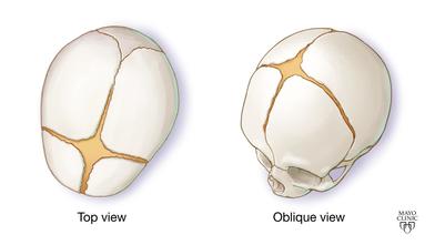 Softspots 2025