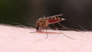 Mayo Clinic Minute Aliviar La Picazon De Las Picaduras De Mosquitos Mayo Clinic