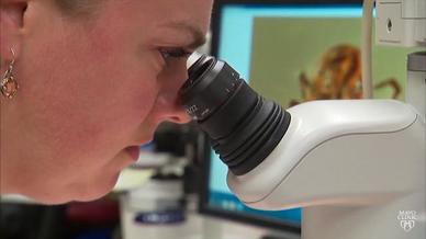 Lyme Disease Symptoms And Causes Mayo Clinic