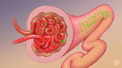 اعت لال ك لوي سكري الأعراض والأسباب Mayo Clinic مايو كلينك