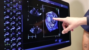 4th Annual Multimodality Cardiac Imaging 2018 Mayo Clinic School