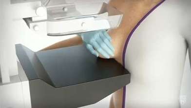 Video: Mammogram for breast cancer — What to expect - Mayo Clinic