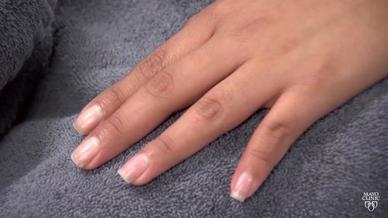 Psoriasis Sintomas Y Causas Mayo Clinic