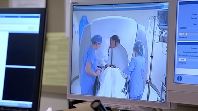 Stereotactic Radiosurgery Mayo Clinic