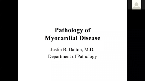 Thumbnail for entry 200819-M2-11am-CARD-Pathology of Restrictive and Dilated Cardiomyopathies-Dalton