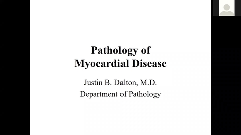 Thumbnail for 200819-M2-11am-CARD-Pathology of Restrictive and Dilated Cardiomyopathies-Dalton