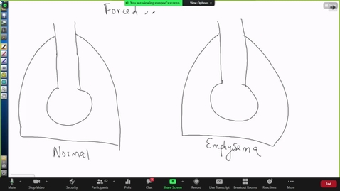 Thumbnail for entry 210914 - M2 - 11am - PULM - Gas Exchange - Costanzo