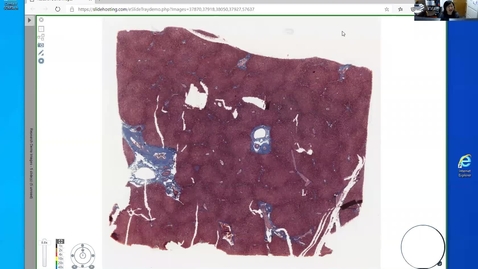 Thumbnail for entry 201202 - M1 - 8am - FD - Normal Histology of Liver and Respiratory System - Sun