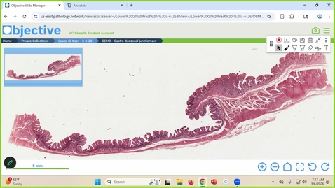 Thumbnail for 260306 - 8AM - M1 - GI - Histology of the Lower GI Tract &amp; Pancreas and Liver - Bigbee