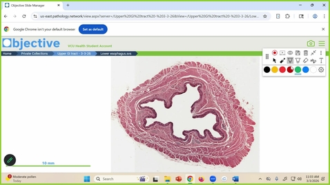 Thumbnail for 260303 - M1 - 11AM - GI - Histology of the Upper GI Tract - GRADED