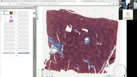 Thumbnail for 210319 - M1 - 9am - GI - Histology of Pancreas and Liver - Sun