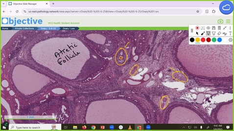 Thumbnail for 250506 - M1 - REP - 10am - Differences in Sexual Differentiation +  Puberty - Nelson