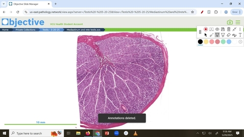 Thumbnail for 250520 - M1 - REP - 10am - Histology of the Testes - Bigbee