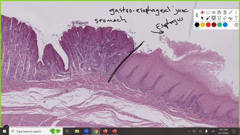 Thumbnail for 250317  - M1 - GI - 10am -  Physiology: Oral Cavity and Esophagus + Gastric Physiology - Anderson