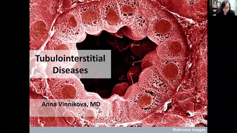 Thumbnail for 201005-M2-9am-RENL-Interstitial Kidney Disease-Vinnikova