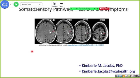 Thumbnail for 241107 - 8AM - M2 - NRS - Somatosensory System II - Jacobs