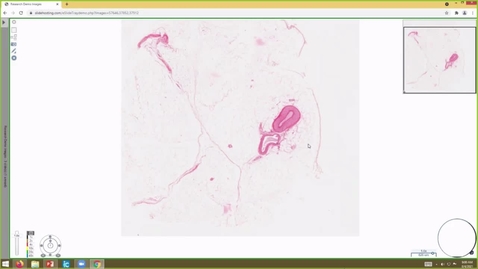 Thumbnail for entry 210804 - M2 - 9am  - CARD - Cardiovascular Histology - Bigbee