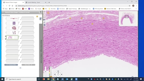 Thumbnail for 201201-M1-8am-FD-Normal Histology of Tubular Organs: GI Tract and Blood Vessels-Bigbee