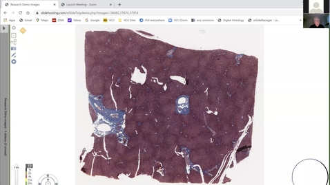 Thumbnail for 210319 - M1 - 9am - GI - Histology of Pancreas and Liver - Bigbee