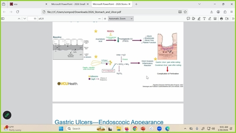 Thumbnail for 260330 - 9AM - M1 - GI - Polyps/Colon Cancer
