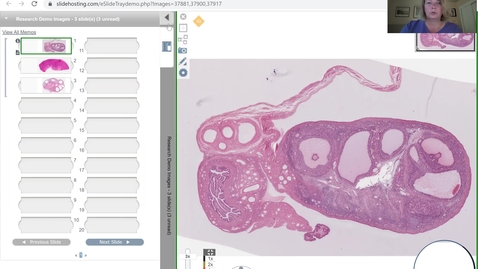 Thumbnail for 210504-M1-8am-REPR-Histology of the Ovary-Colello