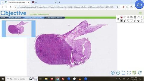 Thumbnail for 250404  - M1 - ENDO - 10am -  Histology of Endocrine Organs - Bigbee