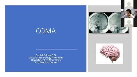 Thumbnail for 201116-M2-11am-MBB-Coma-Falcao