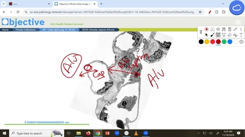 Thumbnail for 241118 - M1 - FOD - 10am - Cell Injury/Cell Death/Adaptation - Sanford