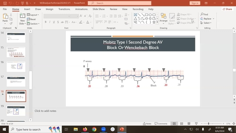 Thumbnail for 240806 - 9AM - M2 - CARD - Atrial and Ventricular arrhythmias pt 1