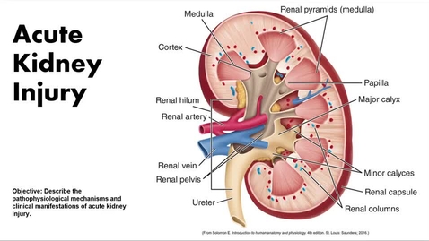 Thumbnail for 450 AKI -Interactive Presentation